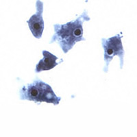 Naegleria trophA.JPG