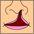 Cleftlip2.svg