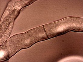 Neurospora crassahyphae.jpg