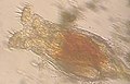 Rotifer.jpg