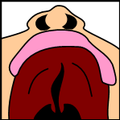 Cleftpalate3.png