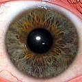 Iris.eye.225px.jpg