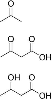 Химическая структура трёх кетоновых тел: ацетон, ацетоуксусная, и бета-оксимасляная кислоты[1]