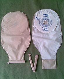 Ileostomy bag.jpg