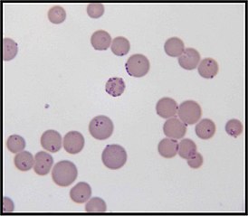 Mycoplasma haemofelis